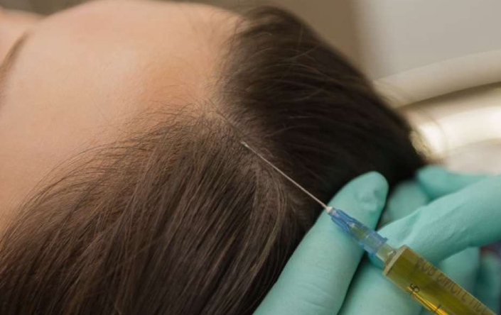 Hair Regrowth Treatment Cost in Ludhiana | Best Doctor for Hair Regrowth in  Ludhaina